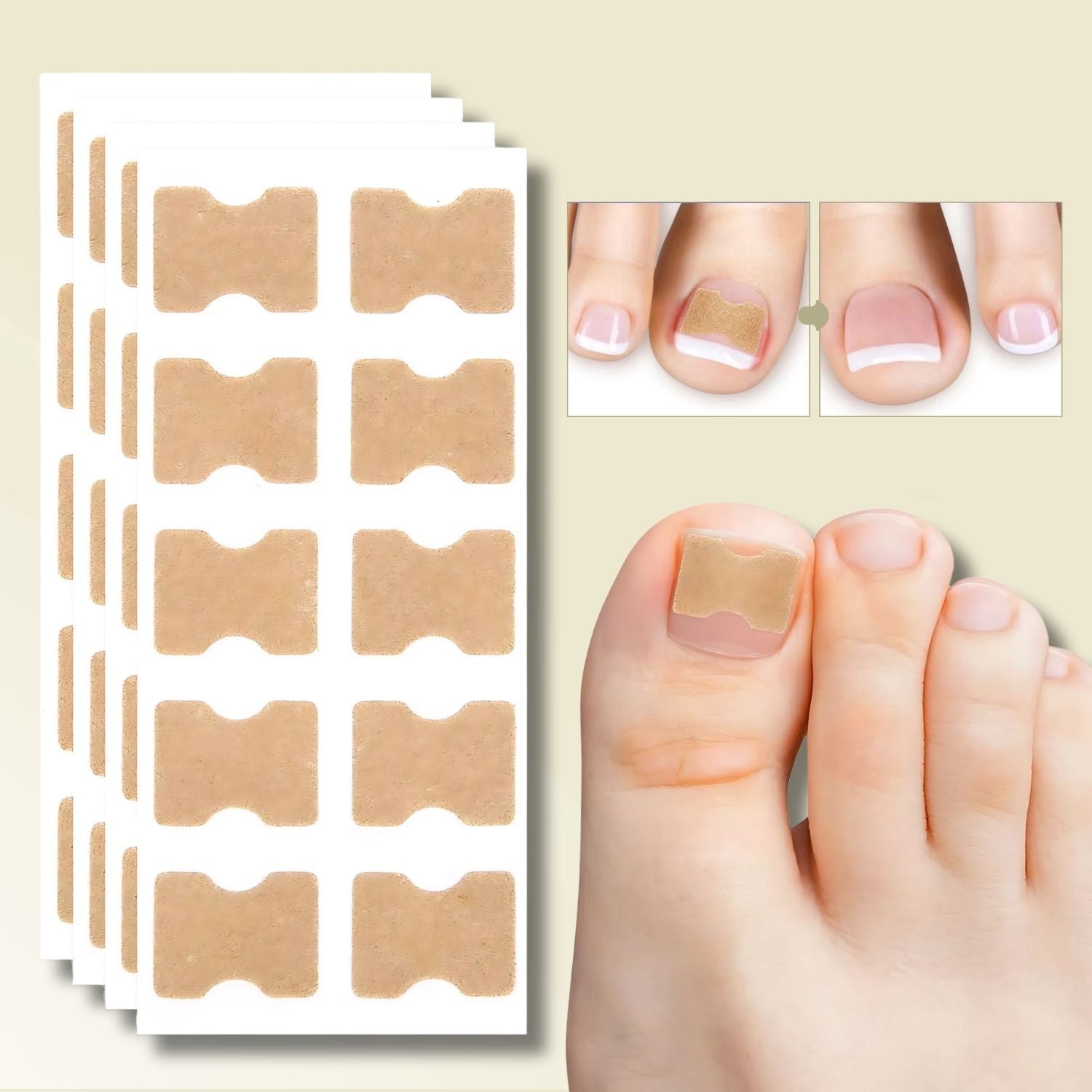 Fungus Nail Patches | Ingrown Nail Treatment-Nail Patches-Lightsnest