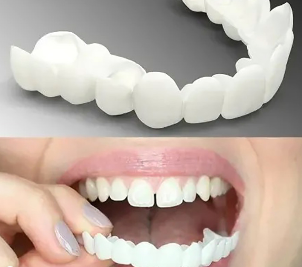 Removable Veneers | Clip On Teeth-Denture-Lightsnest