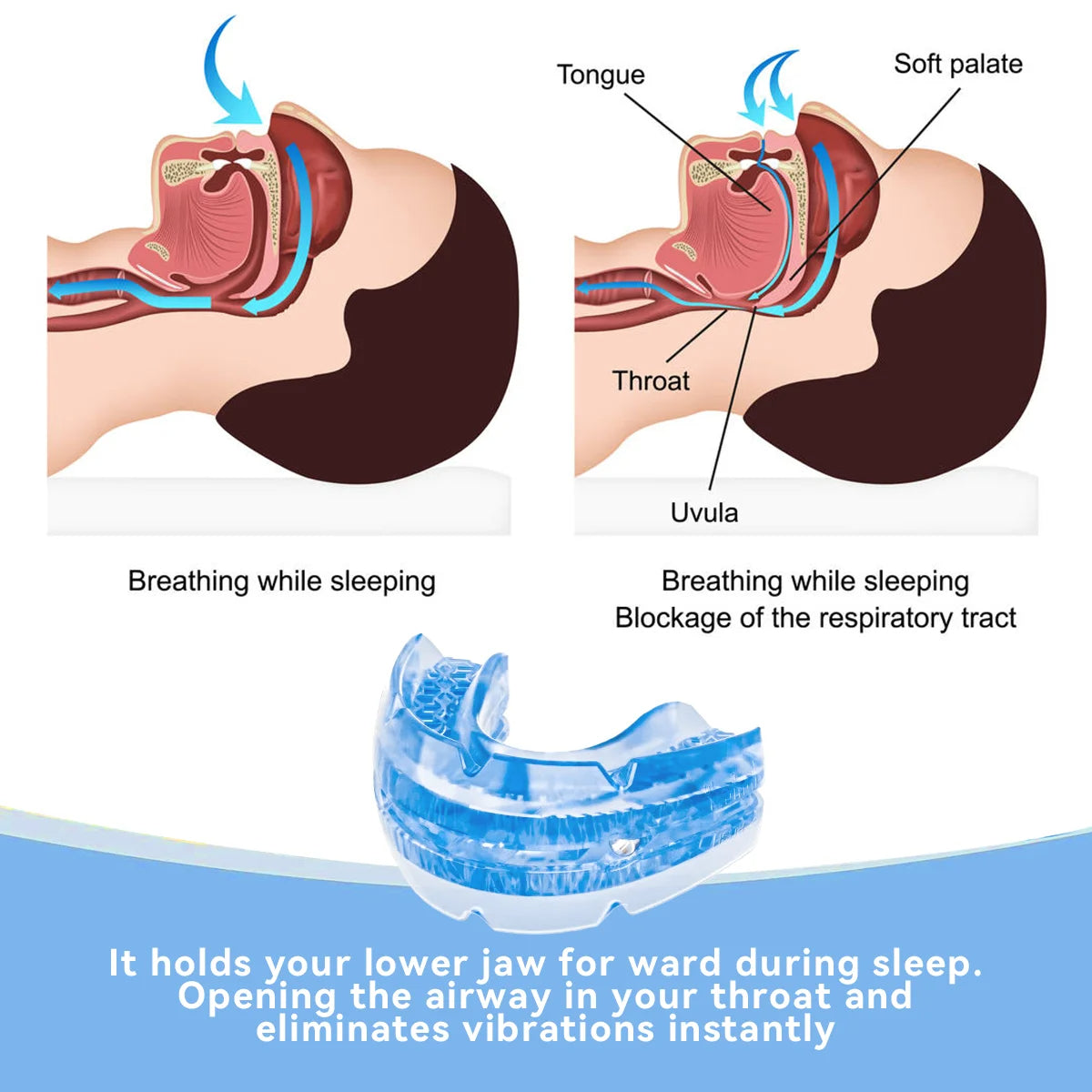 Snoring Mouthpiece | Stop Snoring Mouthpiece-Snoring Device-Lightsnest