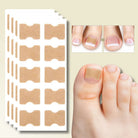 Fungus Nail Patches | Ingrown Nail Treatment-Nail Patches-Lightsnest
