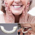 Smile Veneers | Dental Cosmetic Overlay-Veneers-Lightsnest
