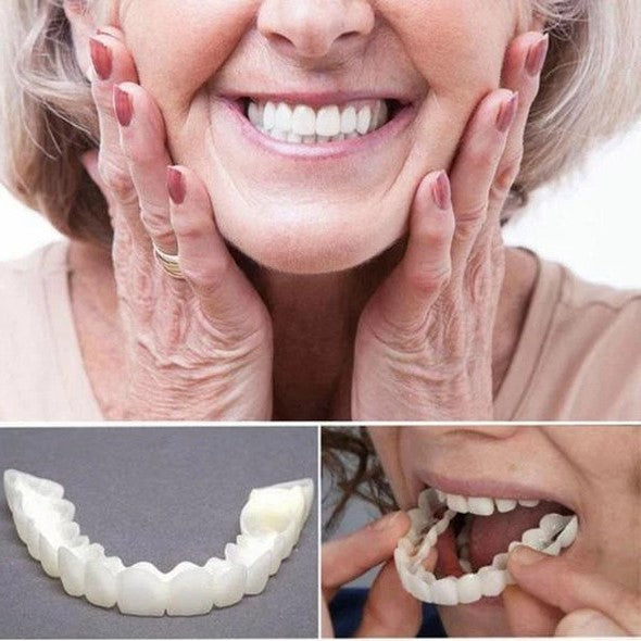 Smile Veneers | Dental Cosmetic Overlay-Veneers-Lightsnest