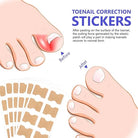 Fungus Nail Patches | Ingrown Nail Treatment-Nail Patches-Lightsnest