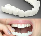 Removable Veneers | Clip On Teeth-Denture-Lightsnest