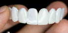 False Teeth | Teeth Coverings-Denture-Lightsnest