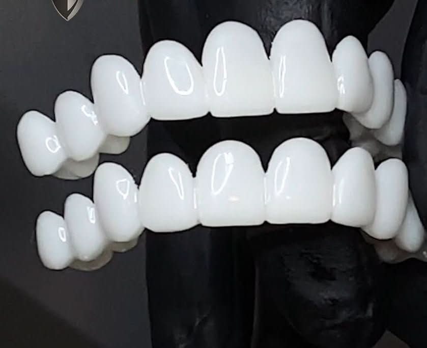 False Teeth | Teeth Coverings-Denture-Lightsnest